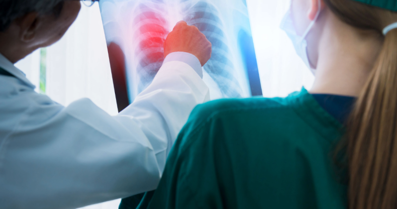 Paranavaí registra redução nos casos de tuberculose, mas Saúde reforça importância do diagnóstico precoce