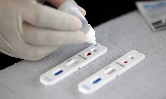Testagem rápida ajuda a identificar HIV, sífilis e hepatites em Paranavaí